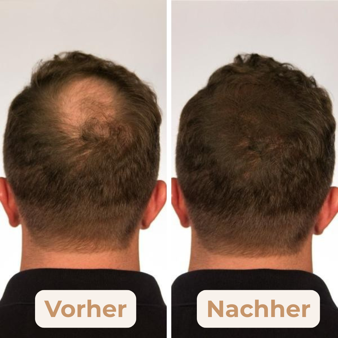 VolumeBlend - Schluss mit peinlichen Haarlöchern