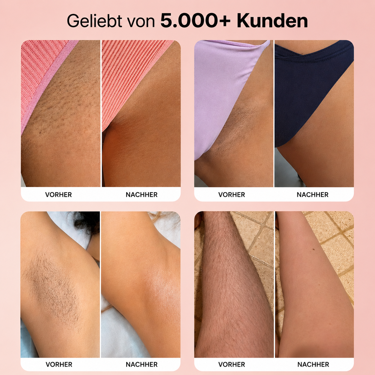 GlowTrim | Glatte Haut