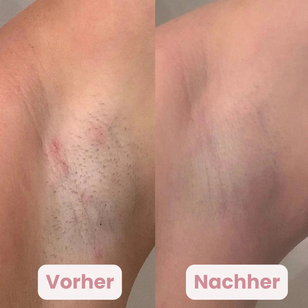 GlowTrim | Body Trimmer