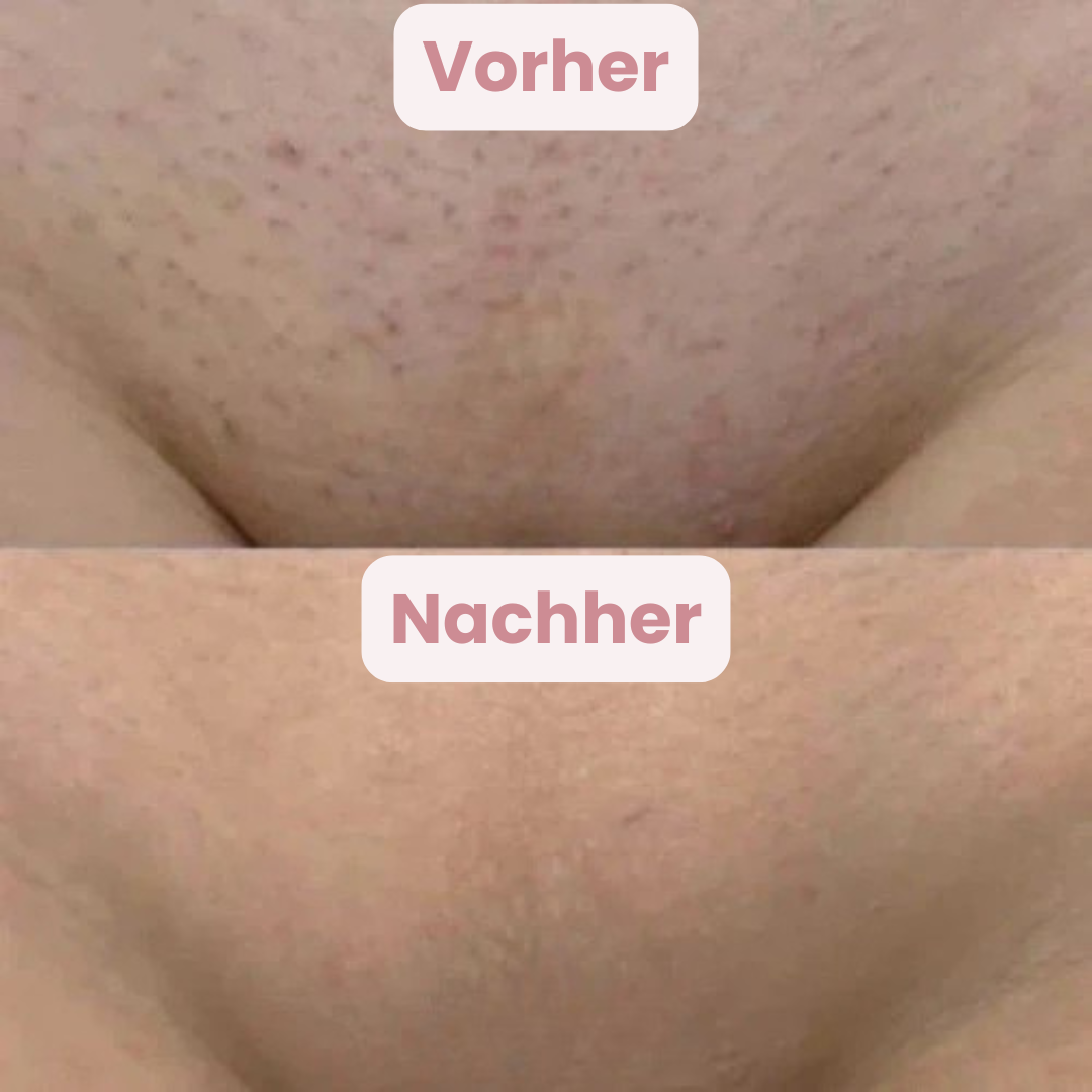 GlowTrim | Glatte Haut