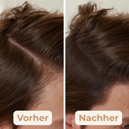VolumeBlend - Schluss mit peinlichen Haarlöchern